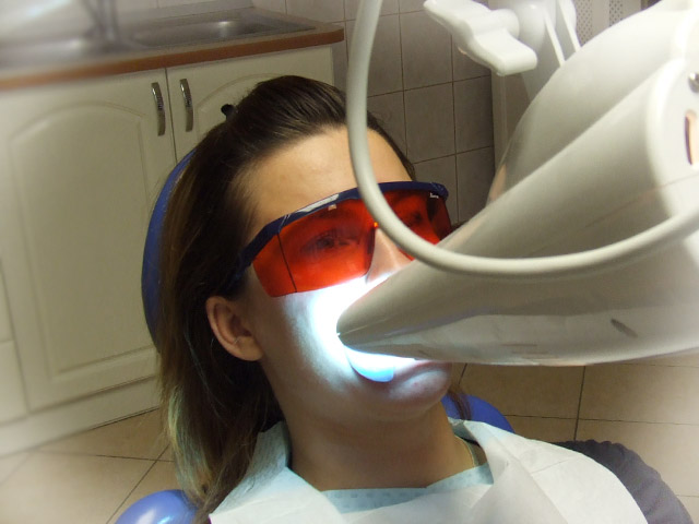 Teeth whitening - Beyond Whitening Accelerator - Dentistry Hungary