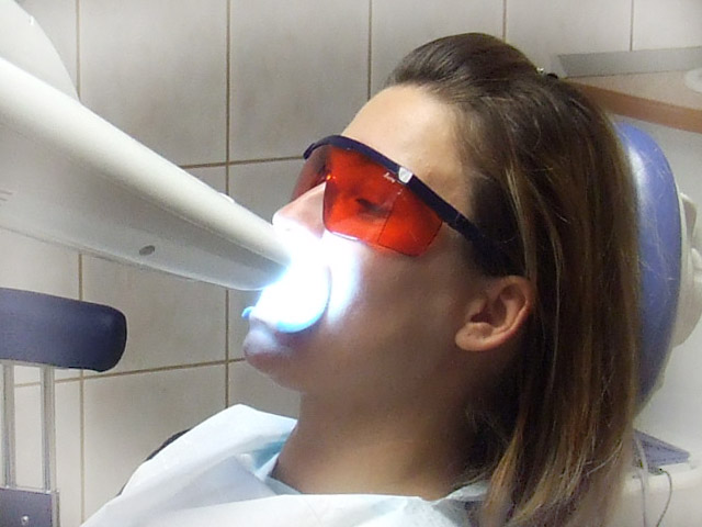 Teeth whitening with White Smile and Beyond Whitening Accelerator - Dental Tourism Hungary