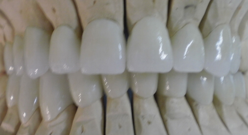 Zirconia crowns - Get beautiful teeth in Hungary!