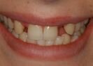 Before the dental treatment