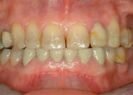 Before dental treatment