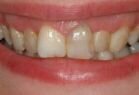 Before the dental treatment