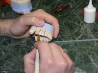 Dental Technicians Laboratory - Dentistry Abroad- UK - Ireland - Hungary